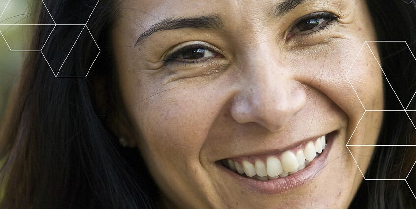 6 cách ngăn ngừa nám da đơn giản nhất