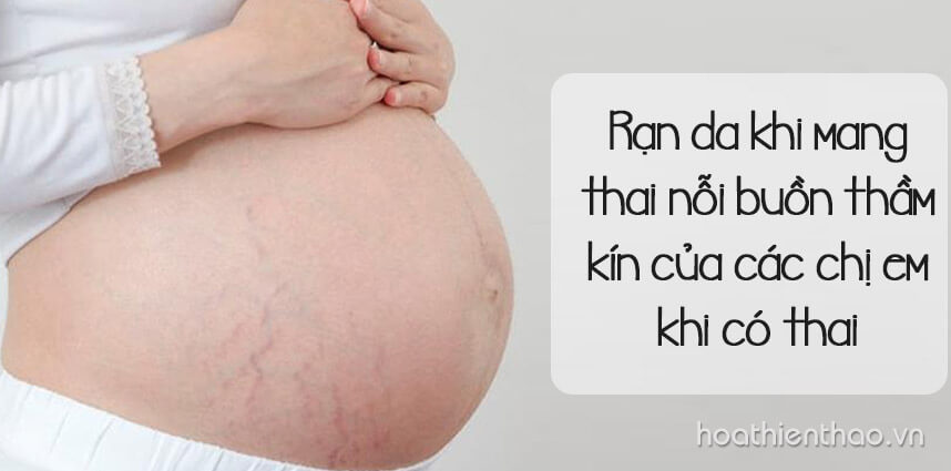 Rạn da khi mang thai nỗi buồn thầm kín của các chị em khi có thai - Hoa Thien Thao