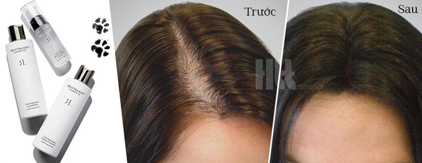 Hiệu quả mọc tóc khi kiên trì sử dụng Serum Revitalash
