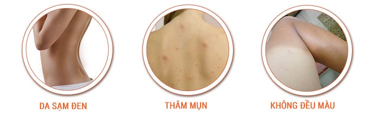 Bộ kem tắm trắng Sakura Super White Pro System