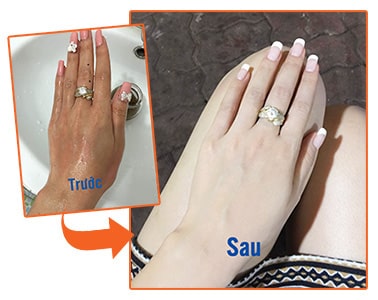 Bộ kem tắm trắng Sakura Super White Pro System