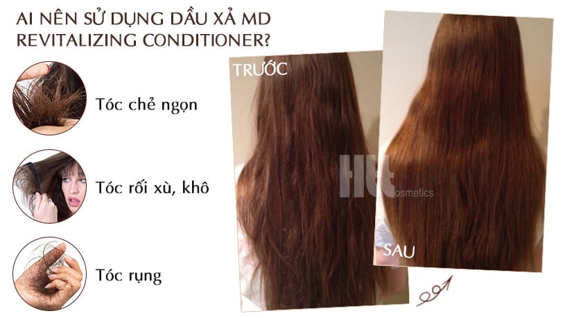 Dầu xả mọc tóc MD Revitalizing Conditioner ngăn ngừa rụng tóc - Hoa Thiên Thảo