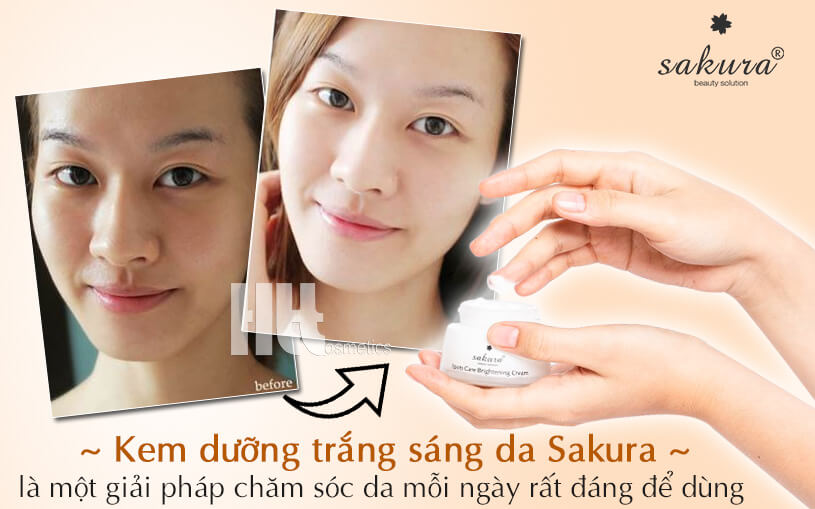 Kem dưỡng trắng sáng da mặt Sakura ngăn ngừa sạm nám - hoathienthaovn
