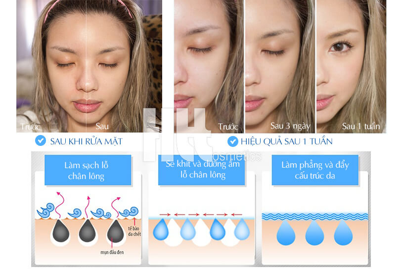Kem rửa mặt A&Plus Cleansing Cream A002 - Hoa Thiên Thảo