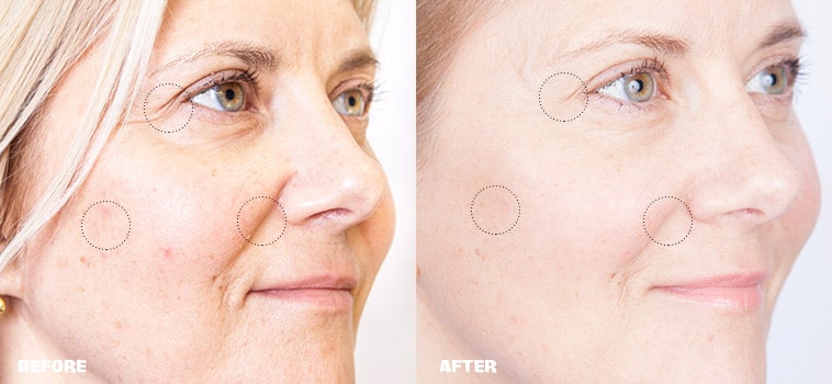 Serum nâng cơ trẻ hóa da Skin Pasíon Anti-Wrinkle Face Lift